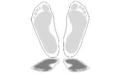 AMANN.ch AG, Basel Fussformen Hallux valgus Fussformen Fussabdruck ...